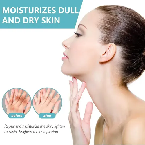Crema 2026 Antiacantosis | Aclara + Suaviza Piel Oscura