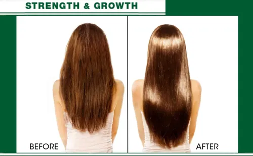Aceite Para Cabello Hair Chemist Con Árbol De Té 210 Ml Mezc