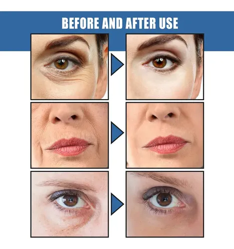 @ty.* 4×crema Antiarrugas Que Aclara Las Líneas Finas Y#