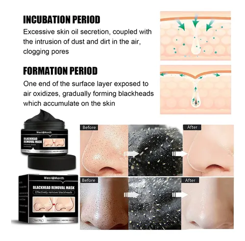 Mascarilla Facial De Carbón Para Puntos Negros