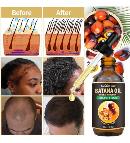 Set Aceite Batana Cuidado Capilar Mascarilla 4 Unidades