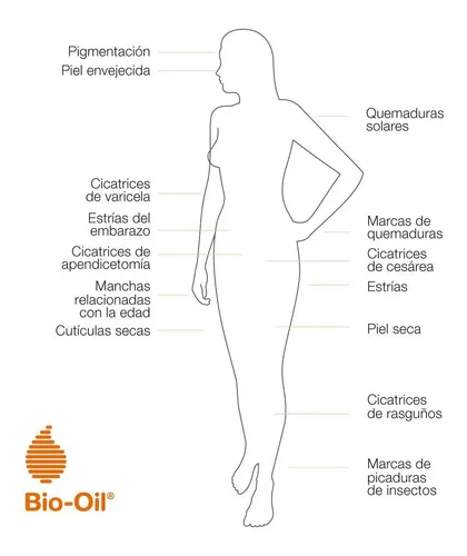 Bio Oil Tratamiento Para Cicatrices, Estrías, Manchas 200 Ml