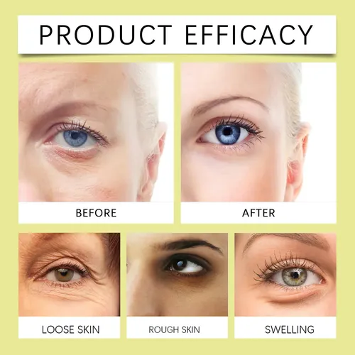 ”eliminador De Arrugas Con Retinol Coreano, Crema, Más