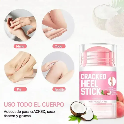 2 Cremas Hidratantes Para Pies Con Un 60% De Urea Y Un 2% De