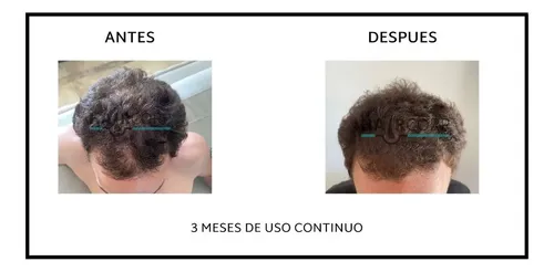 Shampoo Anti Caída Haircorp – Recupera Tu Cabello – Detiene la caida y genera crecimiento