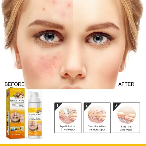 Sérum Facial Eelhoe Para Una Piel Clara Y Minimizar Los Poro