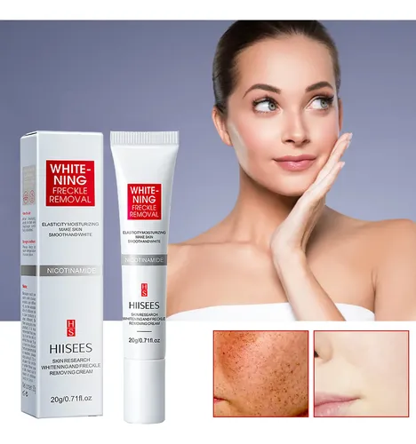 Eliminador De Manchas Oscuras, Melasma, Pecas, Manchas Solar Todo Tipo De Piel Día/noche
