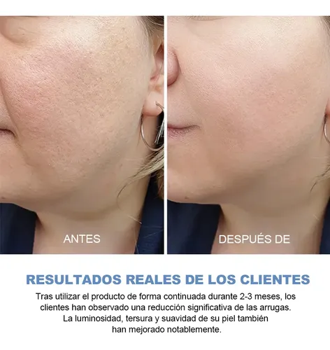 3% 4d Hyaluronic Acid Serum, Deep Nourish, Hydrate, Brighten