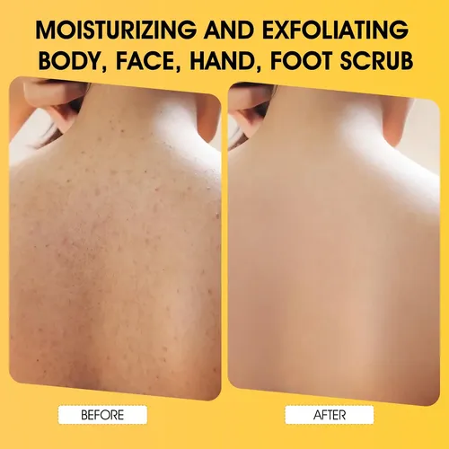 Exfoliante Corporal Voeruy Con Cúrcuma Y Aha, 30 Ml