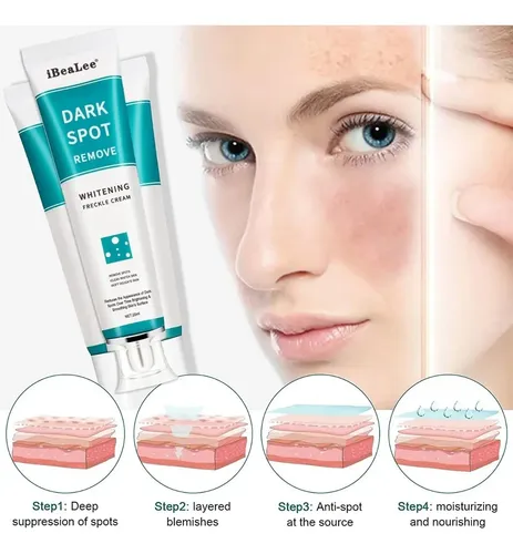 Crema Facial Gel Blanqueadora De Pecas Manchas Acne Rosaceas