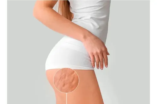Cellu Stop Fresh Cream Anticelulitis Antipoceado Prodermic Fragancia Única