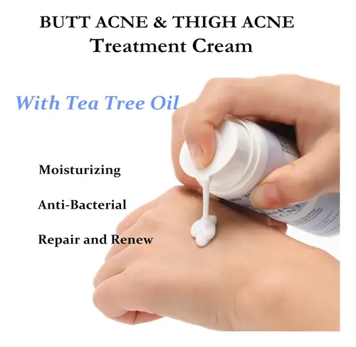 Crema De Aceite De Árbol Para Eliminar El Acné, Cadera Y Mus