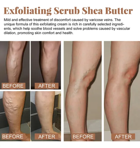 Exfoliante Corporal Suave, Limpieza Profunda, Cuidado De Pi
