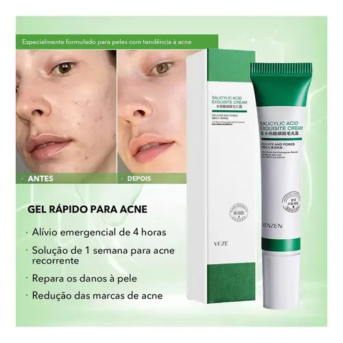 .sa Crema De Ácido Salicílico Z Para Eliminar Los Poros .hg