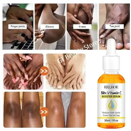 Sérum Iluminador Dark Knuckles Para Codos, Rodillas Y Piel O
