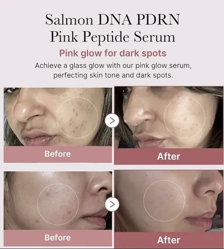 Sérum Facial Pdrn Salmón Pink 10 Ampollas Colageno Hidrata