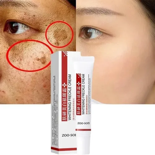 Wu- `pomada Facial Reparator For Branquear Manchas, .m