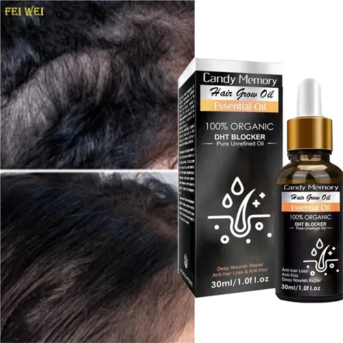 Aceite Capilar Con Extracto De Jengibre (pack De Dos)