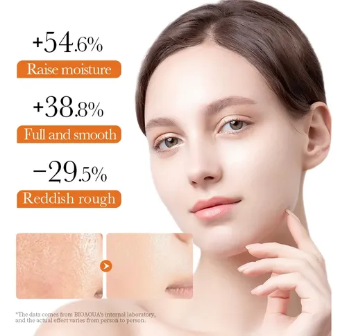 Turmeric Facial Cream – Reduces Acne And Moisturizes50g