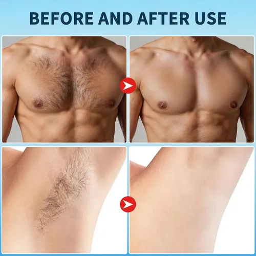 Crema Depilatoria Para Hombres Ybyidu 5-8 Min