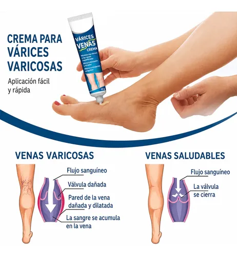 Crema Varices Estrías Descanso Piernas Post Jornada Larga