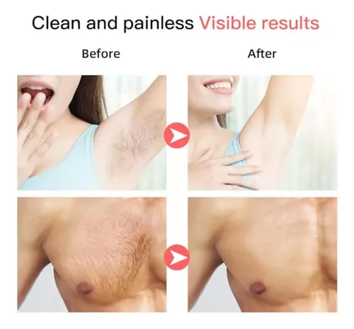 Eficaz Para 100 Tiras De Cera, Tiras De Cera Para El Cuerpo