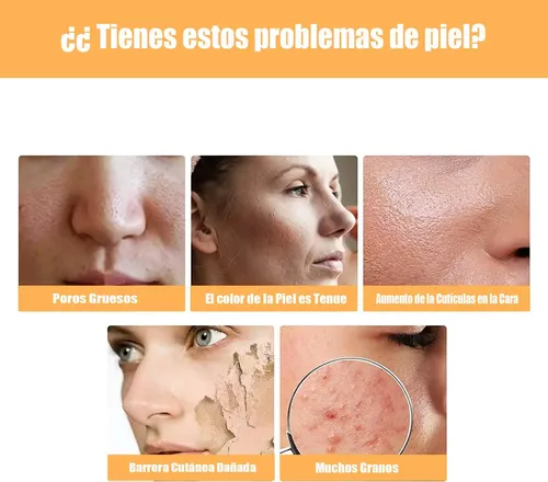 Tónico Facial Ácido Glicólico 7% Exfoliante 100ml