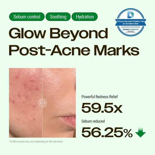 Vvcrema Para Aliviar Las Manchas Del Exosoma De Zinc Xyumu