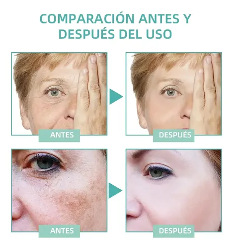 Ae La Crema Correctora De Manchas Aclara Las Manchas Oscuras