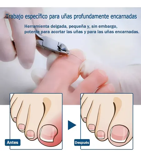 Calidad Superior A Kit De 13pzs Podólogo