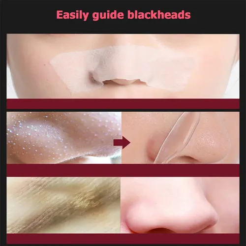 Blackhead Exporting Small Bubble Device Liquid With Ii