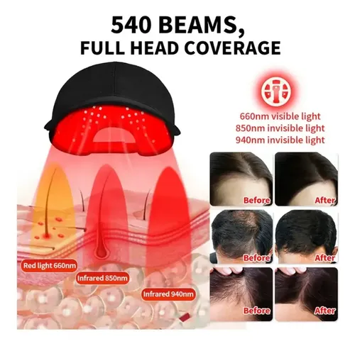 Gorra De Cuidado Capilar Con Luz Roja Led, Forma Perfecta