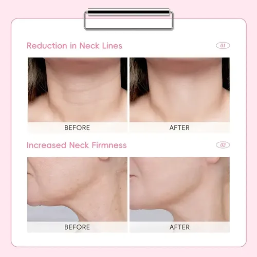 Dssakura Japan Bálsamo Reafirmante Para El Cuello Laikouqsqd