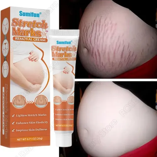 +crema Para Eliminar Estrías, Antiarrugas, Antienvejecimiento.