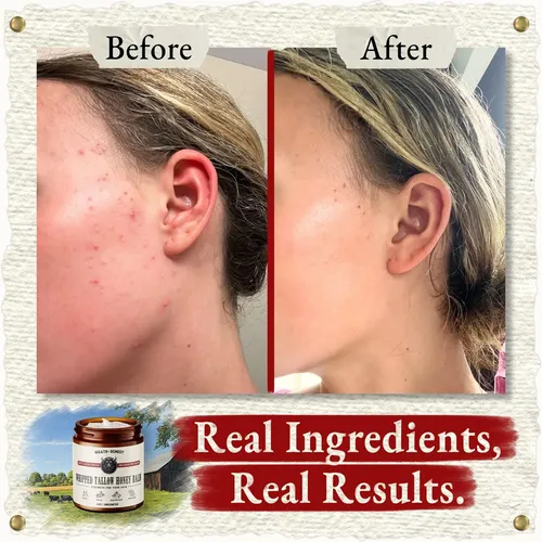 Crema Hidratante Wrath & Remedy De Sebo De Res Orgánico Bati