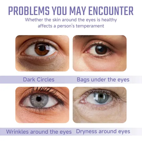 Parches De Colágeno Para Ojos Ouhoe Para Ojeras Y Líneas Fin Normal