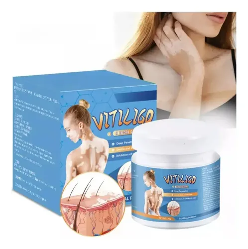 A5080301 Pmpara Crema Para Vitíligo, Elimina Las Manchas