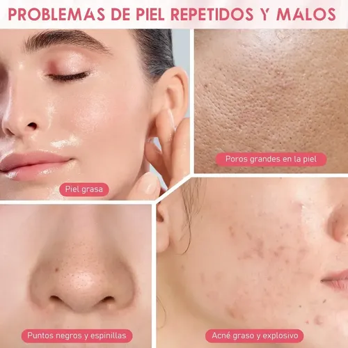 1 Mascarilla De Arcilla Poromizante De Acción Rápida, Zxc