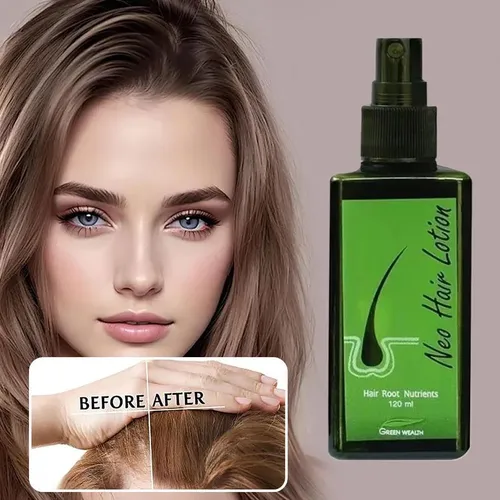 For Neo Hair Lotion Fast Absorbing Natural Hair Recommend