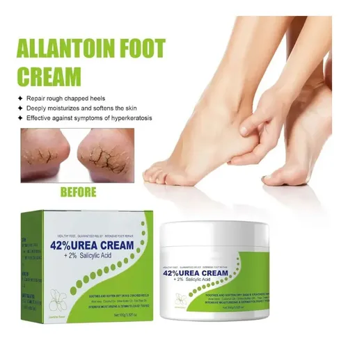 Crema Exfoliante De Urea For Eliminar Los Callos De La Piel