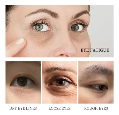 *fc Parches Para Ojos Ojeras Colágeno Oro Arrugas 100 Hh.