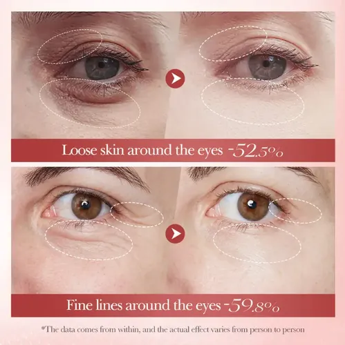 Contorno De Ojos Antiarrugas Bioaqua 20g Caracol