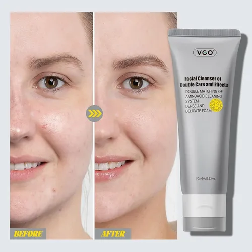 Limpiador Facial Vgo Con Doble Tubo Y Limpieza De Poros