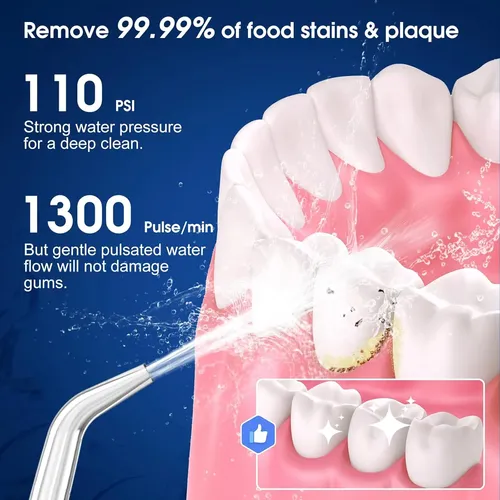 Irrigador Oral Dental Portátil Con 5 Modos Y 6 Puntas-blanco Blanco.