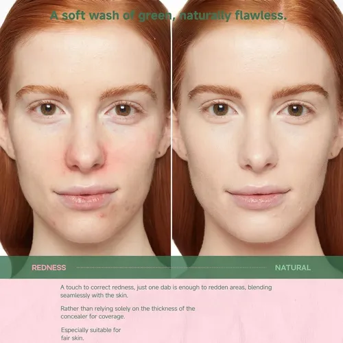 Corrector Verde Con Cica Bb Cream 30 Ml Helbr
