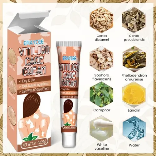 M* Crema Para El Vitíligo Para Reducir Las Manchas *xl