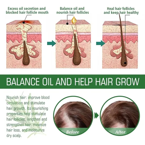 Aceite Para El Crecimiento Y Tratamiento Del Cabello Vvd Ros