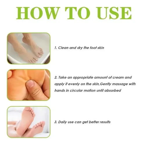 Crema Exfoliante De Urea For Eliminar Los Callos De La Piel