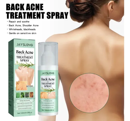 2×cura El Acné Espalda Con Ácido Salicílico Aceite Árb .