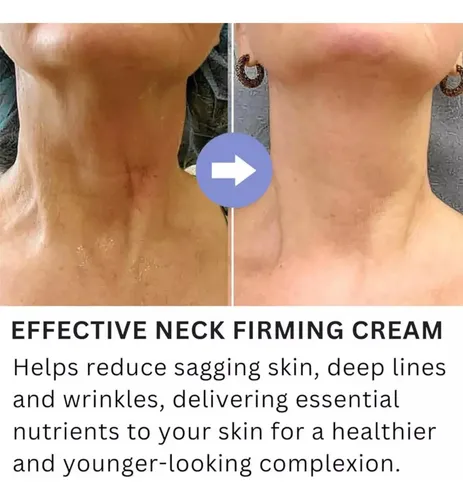 Crema Reafirmante Para Cuello, Efecto Tensor Y Elevador,,;